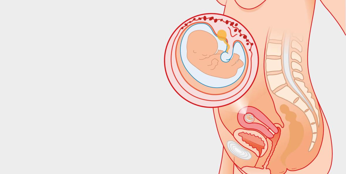 Antenate Health - Now that you're pregnant, it may be tough to handle the  physical and emotional changes that come with pregnancy. What should you do  to get through the first trimester
