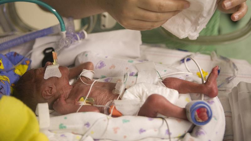 Feeding Your Premature Baby Tommy S